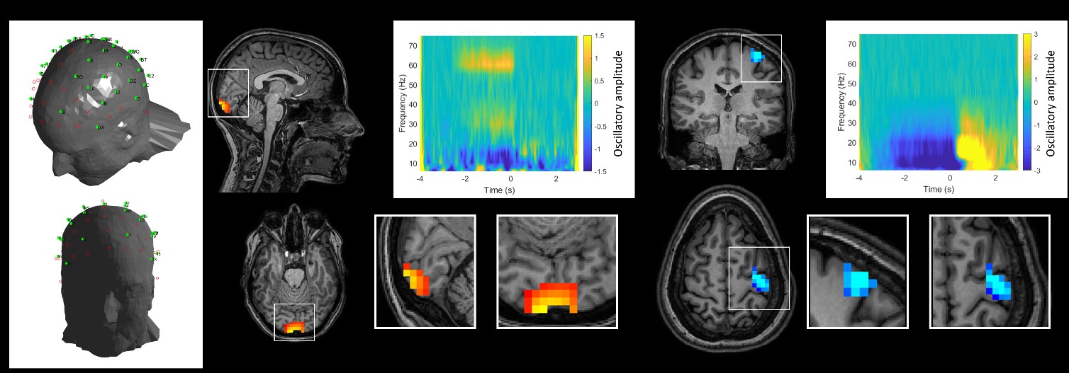 Results of the first 50 channel experiment showing OPM locations, gamma oscillations, and beta modulation