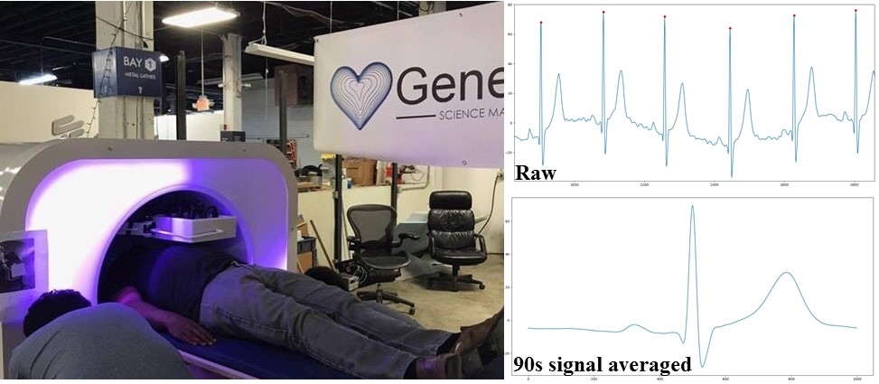Initial MCG tracings recorded by the CardioFlux system in an industrial warehouse