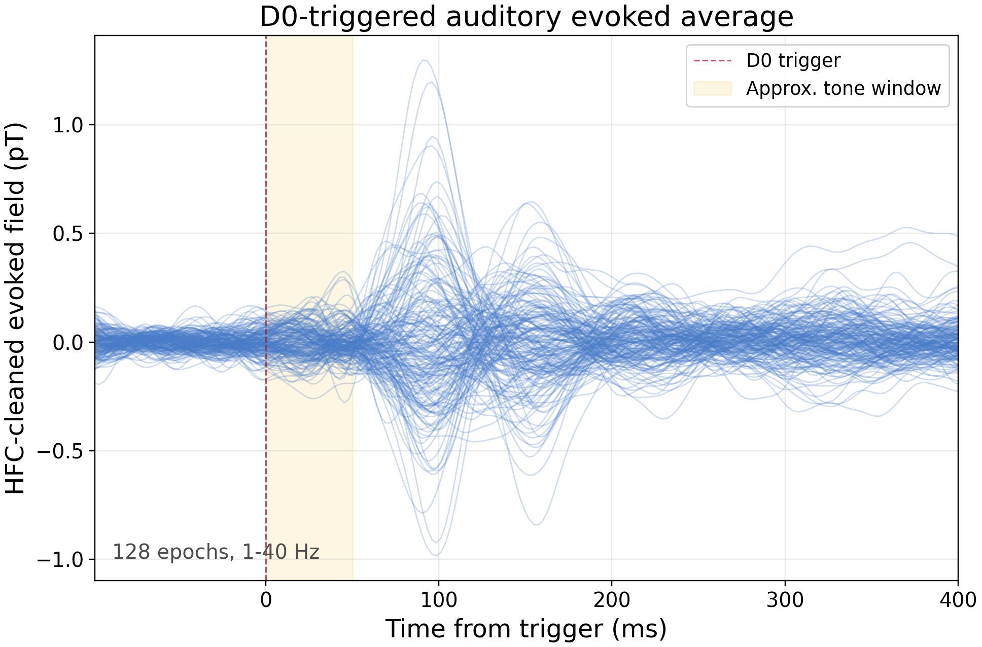 D0-triggered HFC-cleaned auditory evoked average
