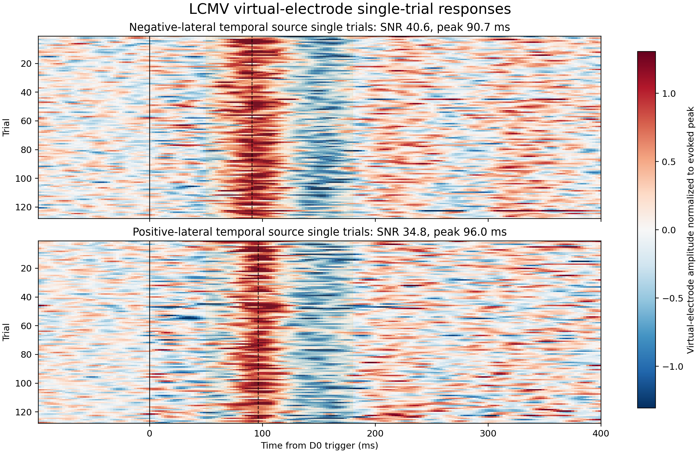 LCMV virtual-electrode single-trial heatmaps