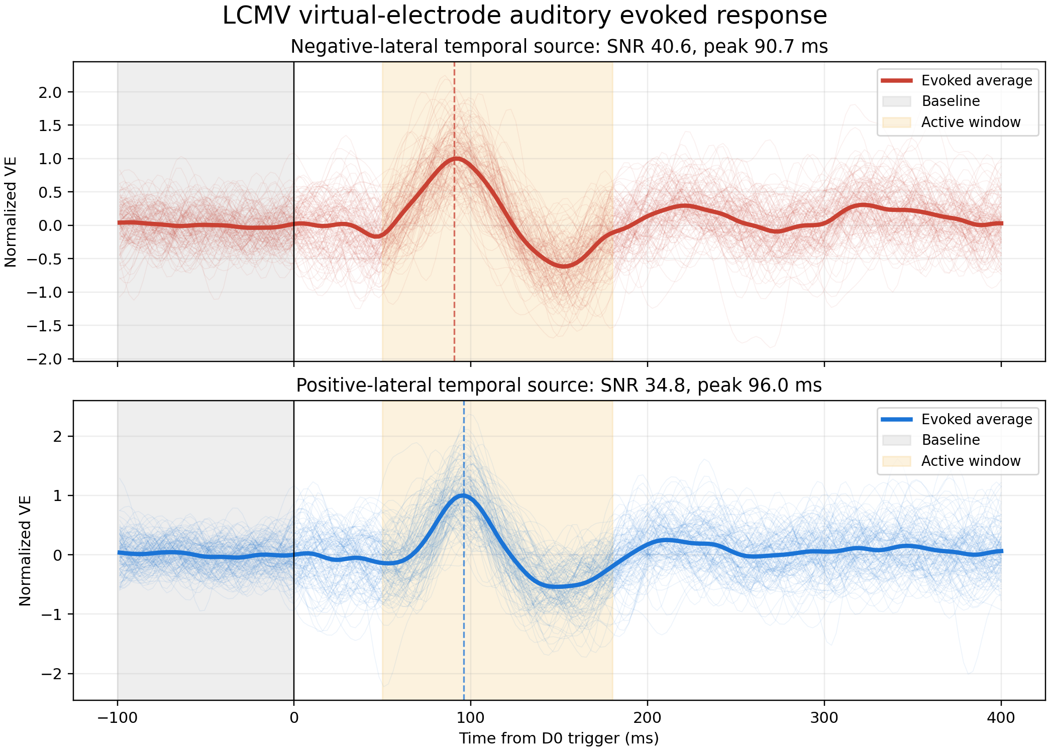 LCMV virtual-electrode auditory evoked response with single trials and bold average