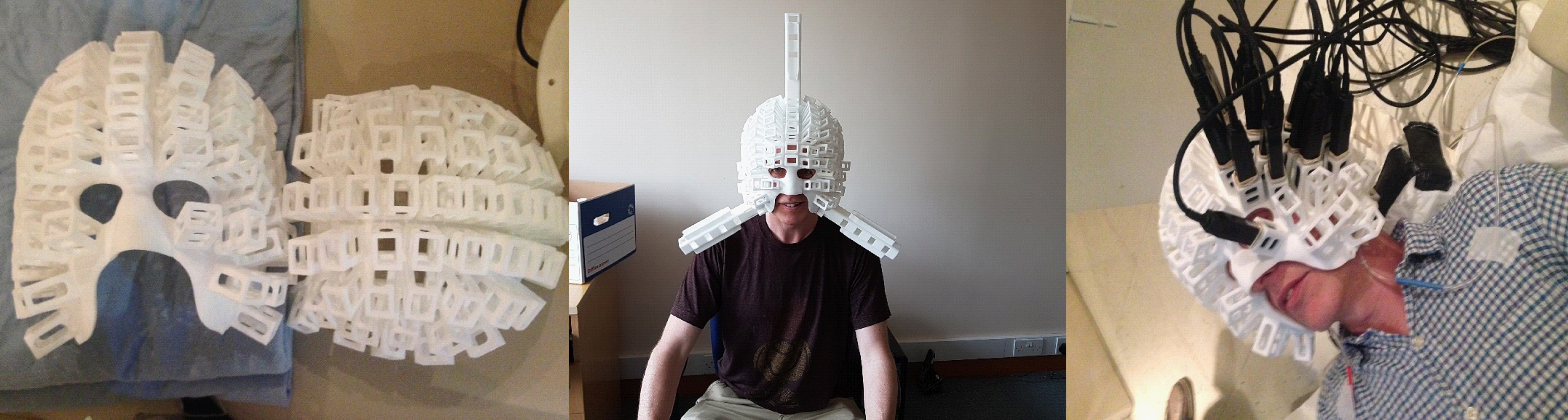 MEG scanner-cast with 123 slots for a full-head 246-channel MEG system