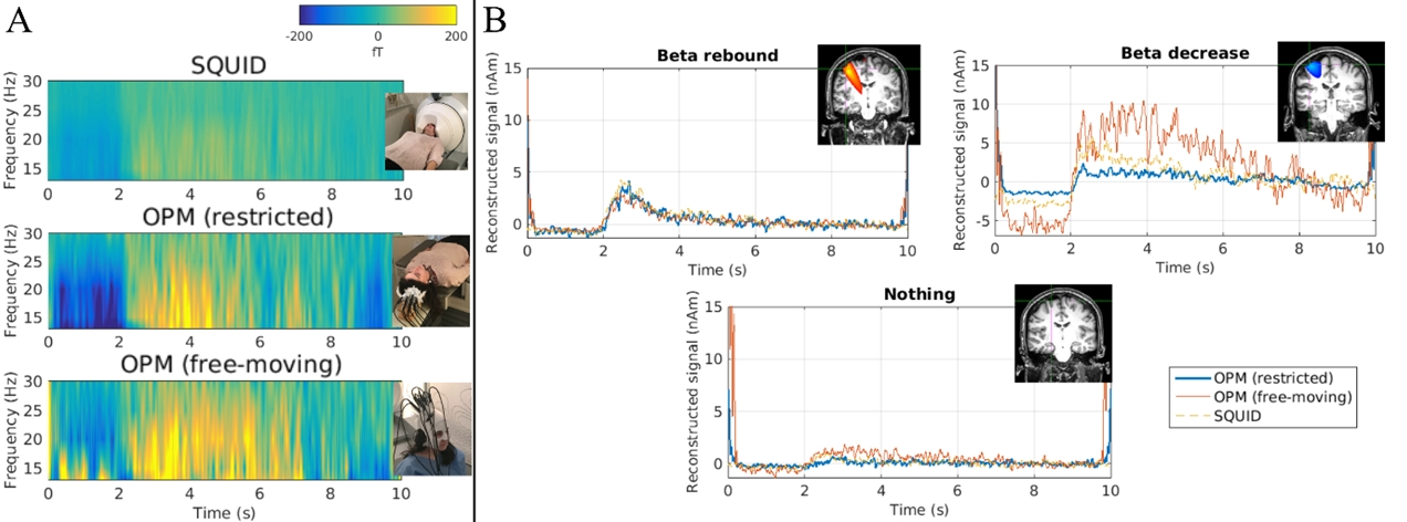 Time-frequency spectra and beamformer-reconstructed time series from the three experiments