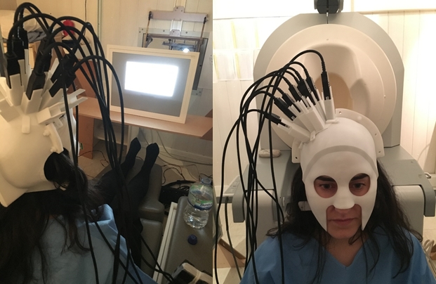 Elena Boto wearing a MEG helmet with 8 OPMs