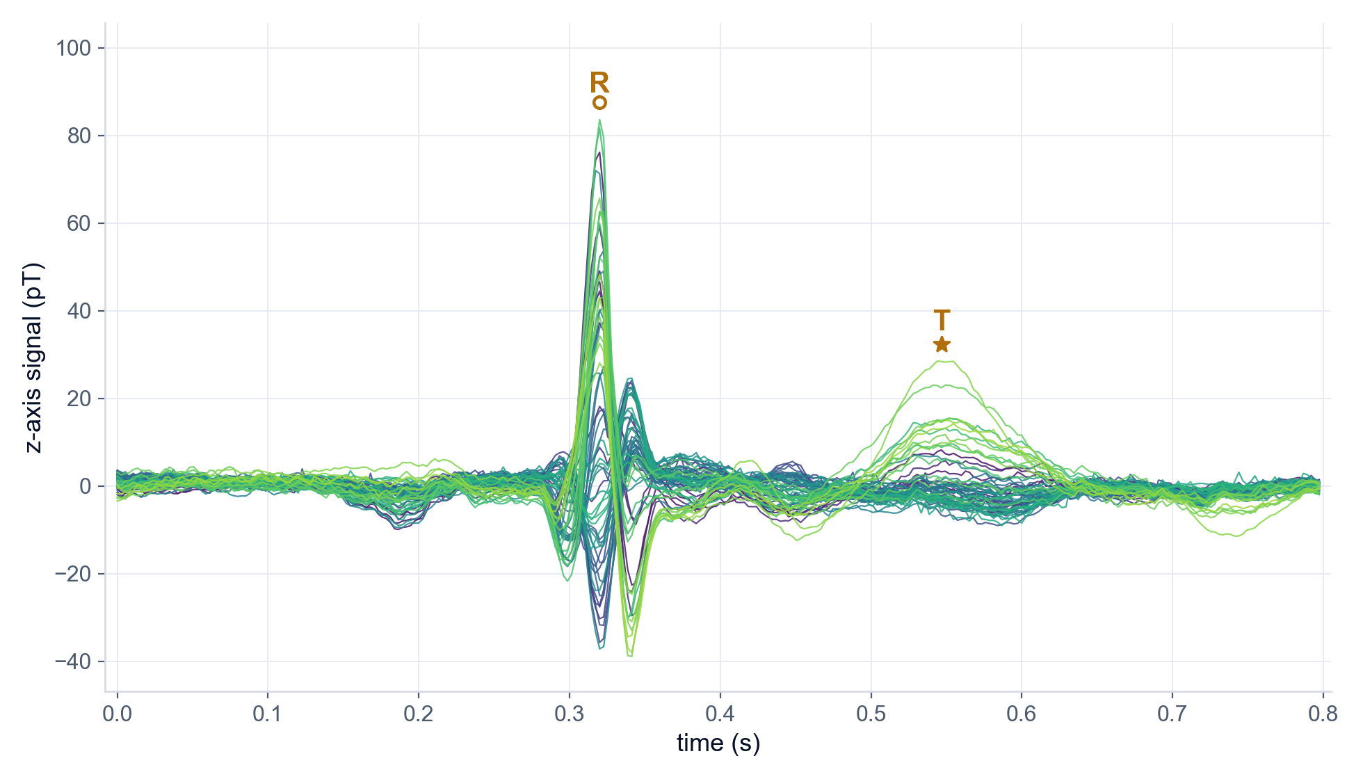 Butterfly plot of 63 overlaid sensor traces for a single heartbeat, with the R-wave spike and T-wave bump marked
