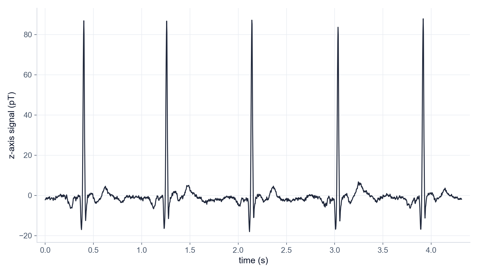 Five consecutive heartbeats recorded by one sensor, showing regular sharp R-wave spikes